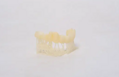 TC100 Temporary Crown & Bridge Resin - pryskyřice pro zubní modelovaní